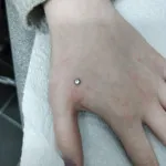 Hand piercing