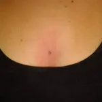Chest piercing