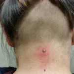 Neck piercing