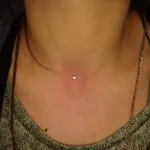 Chest piercing